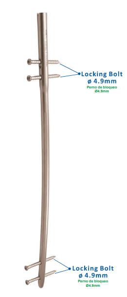 DAKSH Universal Femur Nail